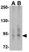 Transient Receptor Potential Cation Channel Subfamily C Member 3 antibody, GTX31626, GeneTex, Western Blot image 