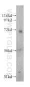 Pregnancy Specific Beta-1-Glycoprotein 1 antibody, 11809-1-AP, Proteintech Group, Western Blot image 