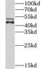 Choline kinase alpha antibody, FNab01665, FineTest, Western Blot image 