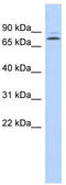 Kelch-like protein 14 antibody, TA339243, Origene, Western Blot image 