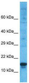 PR domain zinc finger protein 5 antibody, TA345261, Origene, Western Blot image 