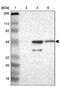 Heterogeneous nuclear ribonucleoprotein H2 antibody, PA5-51566, Invitrogen Antibodies, Western Blot image 