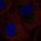 DEAD-Box Helicase 6 antibody, PA5-55012, Invitrogen Antibodies, Immunofluorescence image 