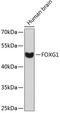 Forkhead Box G1 antibody, 14-393, ProSci, Western Blot image 
