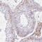 Ankyrin Repeat Domain 53 antibody, PA5-62011, Invitrogen Antibodies, Immunohistochemistry paraffin image 