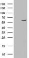 Glucosylceramidase Beta antibody, LS-C338727, Lifespan Biosciences, Western Blot image 