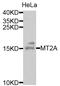 Metallothionein 2A antibody, abx001638, Abbexa, Western Blot image 