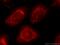 Activating Transcription Factor 6 antibody, 24169-1-AP, Proteintech Group, Immunofluorescence image 