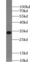 Uridine-Cytidine Kinase 2 antibody, FNab09223, FineTest, Western Blot image 
