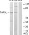 TATA-Box Binding Protein Associated Factor 5 Like antibody, TA315365, Origene, Western Blot image 