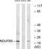 NADH:Ubiquinone Oxidoreductase Subunit B9 antibody, TA312920, Origene, Western Blot image 
