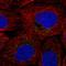 ROS Proto-Oncogene 1, Receptor Tyrosine Kinase antibody, HPA072424, Atlas Antibodies, Immunocytochemistry image 