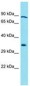 Galactosidase Beta 1 Like 3 antibody, TA337320, Origene, Western Blot image 