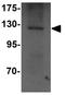 NLR Family Pyrin Domain Containing 14 antibody, GTX85152, GeneTex, Western Blot image 