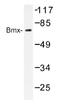 BMX Non-Receptor Tyrosine Kinase antibody, AP01173PU-N, Origene, Western Blot image 