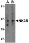 NK-3R antibody, PA5-20392, Invitrogen Antibodies, Western Blot image 