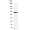 pp60c-src antibody, R30485, NSJ Bioreagents, Western Blot image 