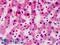 Mediator Complex Subunit 4 antibody, LS-B4986, Lifespan Biosciences, Immunohistochemistry paraffin image 