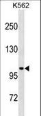 StAR Related Lipid Transfer Domain Containing 13 antibody, LS-C156161, Lifespan Biosciences, Western Blot image 