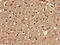 Carboxyl-terminal PDZ ligand of neuronal nitric oxide synthase protein antibody, LS-C678837, Lifespan Biosciences, Immunohistochemistry paraffin image 