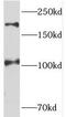 Testis Expressed 14, Intercellular Bridge Forming Factor antibody, FNab08609, FineTest, Western Blot image 