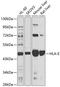 Major Histocompatibility Complex, Class I, E antibody, A01944, Boster Biological Technology, Western Blot image 