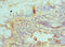 Bleomycin Hydrolase antibody, LS-C375314, Lifespan Biosciences, Immunohistochemistry paraffin image 