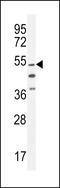 Integrator Complex Subunit 14 antibody, LS-C168905, Lifespan Biosciences, Western Blot image 
