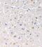 TNF Receptor Superfamily Member 6b antibody, GTX28405, GeneTex, Immunohistochemistry paraffin image 