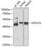VPS37A Subunit Of ESCRT-I antibody, GTX55841, GeneTex, Western Blot image 