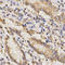 TAP Binding Protein antibody, LS-C331792, Lifespan Biosciences, Immunohistochemistry paraffin image 