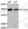 ELOVL Fatty Acid Elongase 6 antibody, A3488, ABclonal Technology, Western Blot image 