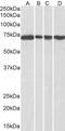 DEAD-Box Helicase 5 antibody, TA302658, Origene, Western Blot image 
