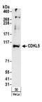 Cyclin-dependent kinase-like 5 antibody, A304-172A, Bethyl Labs, Western Blot image 