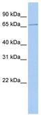 Scm Polycomb Group Protein Homolog 1 antibody, TA329388, Origene, Western Blot image 