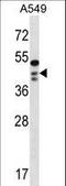 STN1 Subunit Of CST Complex antibody, LS-C163096, Lifespan Biosciences, Western Blot image 