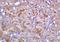Prolactin Induced Protein antibody, orb157078, Biorbyt, Immunohistochemistry paraffin image 