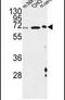 Activating Transcription Factor 6 Beta antibody, PA5-25025, Invitrogen Antibodies, Western Blot image 