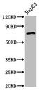 Alkylglycerone Phosphate Synthase antibody, CSB-PA001457LA01HU, Cusabio, Western Blot image 