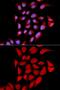 Proteasome Subunit Alpha 6 antibody, GTX32815, GeneTex, Immunocytochemistry image 