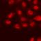 SET Binding Protein 1 antibody, LS-C668114, Lifespan Biosciences, Immunofluorescence image 