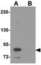 Storkhead Box 2 antibody, GTX85136, GeneTex, Western Blot image 