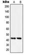 Serpin B5 antibody, LS-C352659, Lifespan Biosciences, Western Blot image 