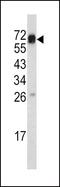Endoglin antibody, PA5-12511, Invitrogen Antibodies, Western Blot image 