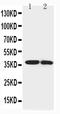 Insulin Like Growth Factor Binding Protein 1 antibody, PA1480, Boster Biological Technology, Western Blot image 