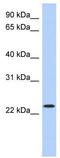Cyclic AMP-dependent transcription factor ATF-3 antibody, TA341639, Origene, Western Blot image 