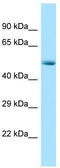 Cyclin Dependent Kinase 8 antibody, TA329126, Origene, Western Blot image 