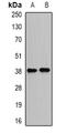 Proline And Serine Rich Coiled-Coil 1 antibody, abx141312, Abbexa, Western Blot image 