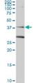 DNA repair protein RAD51 homolog 3 antibody, H00005889-M01, Novus Biologicals, Western Blot image 