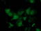 Chromosome 1 Open Reading Frame 50 antibody, TA502902, Origene, Immunofluorescence image 
